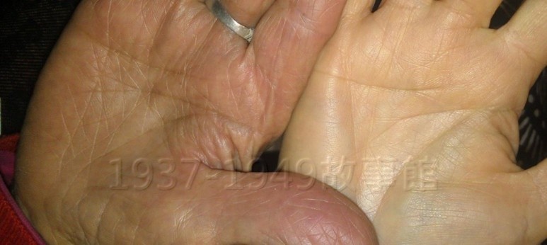 圖三 左為姑婆之手,右為媽媽之手。當妳驚訝於有相似的掌紋之時,背後的意義是,兩個人輾轉流著相同的血──這便是「根」的展現,本是同根生。